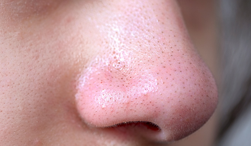 The Ultimate Guide to Sebaceous Filaments: What They Are & How to Keep Them Clear