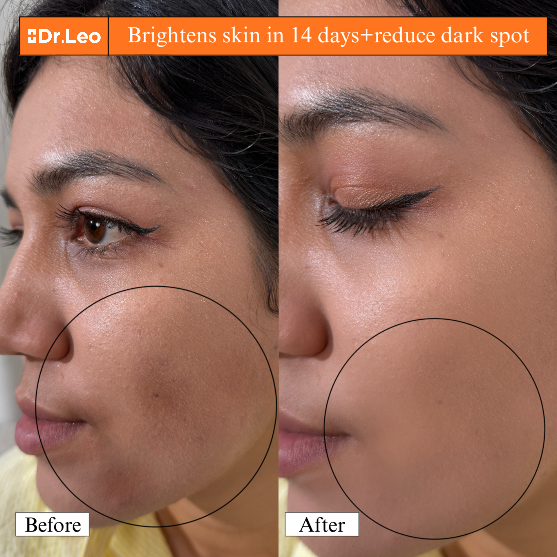 377 & VC Whitening & Spot Fading Essence