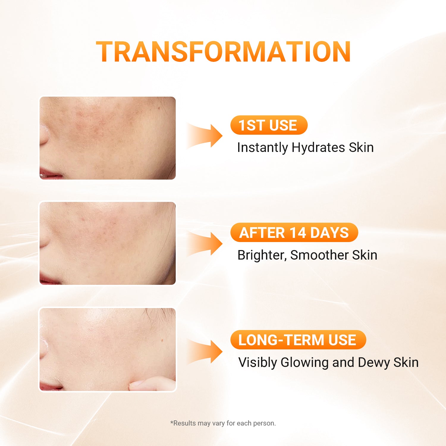 Niacinamide 377 VC Brightening Cream