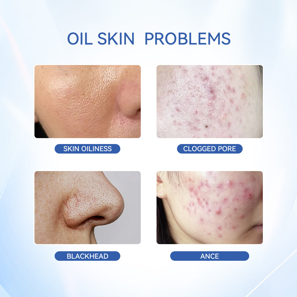 Mascarilla de Arcilla Purificante y Limpieza Profunda de Poros con Arcilla Blanca Amazónica - 2 Piezas