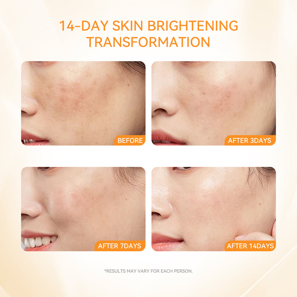 377 & VC Whitening & Spot Fading Essence