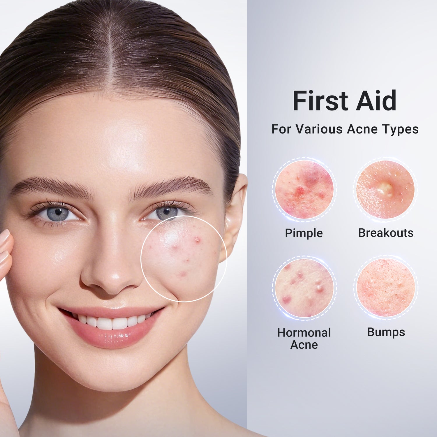 3-Step Acne Control Routine (Cleanser + Cleansing Clay Stick + Drying Lotion Plus)