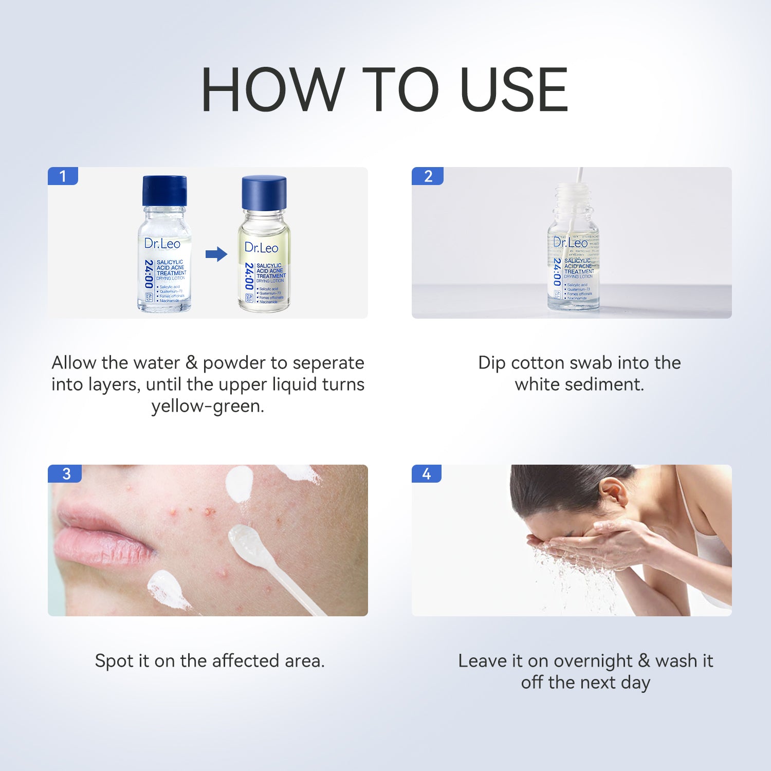 Salicylic Acid Acne Treatment Drying Lotion