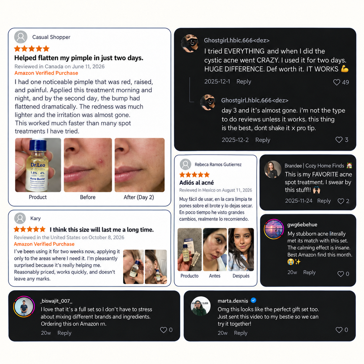 Acne Buster Kit