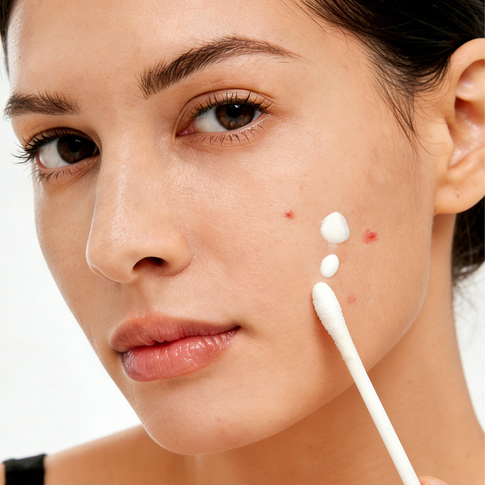 How to Apply & Remove Dr. Leo Acne Treatments: Official Guide
