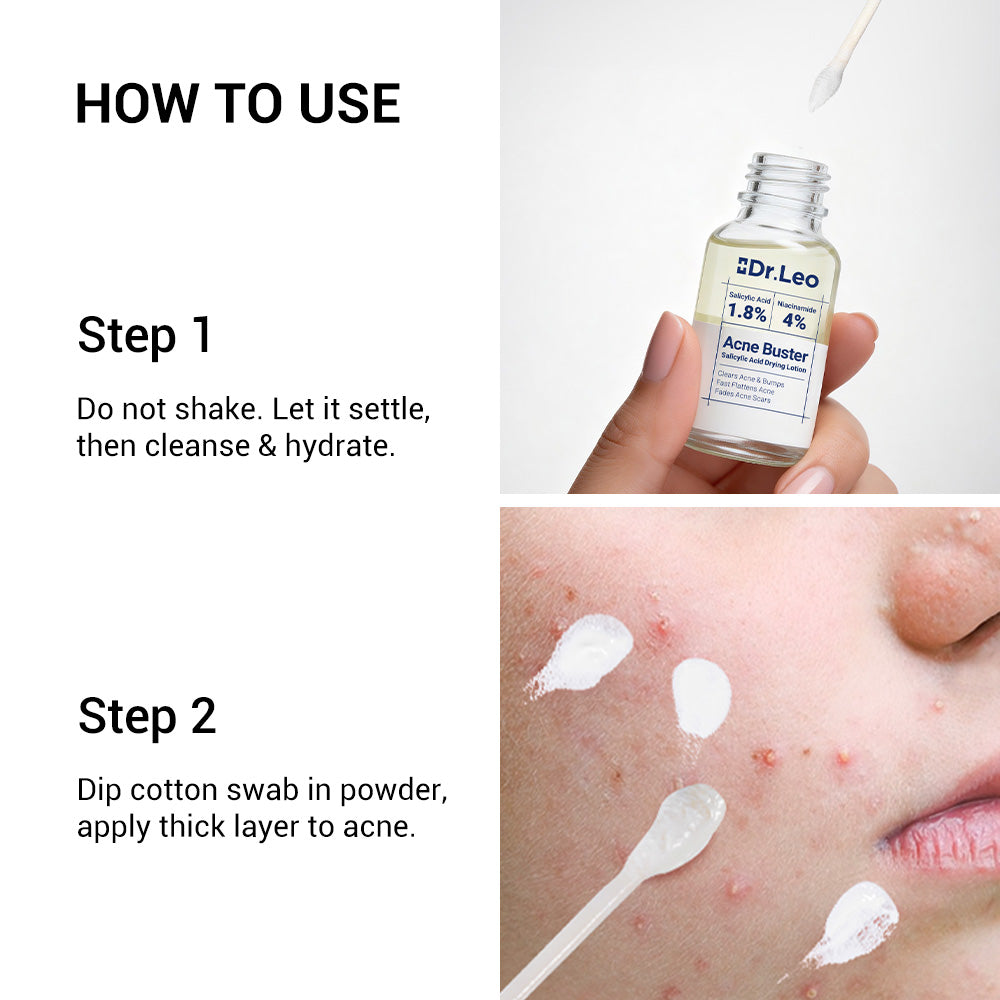 Acne Drying Lotion Plus (1.8% Encapsulated Salicylic Acid) — 20 mL