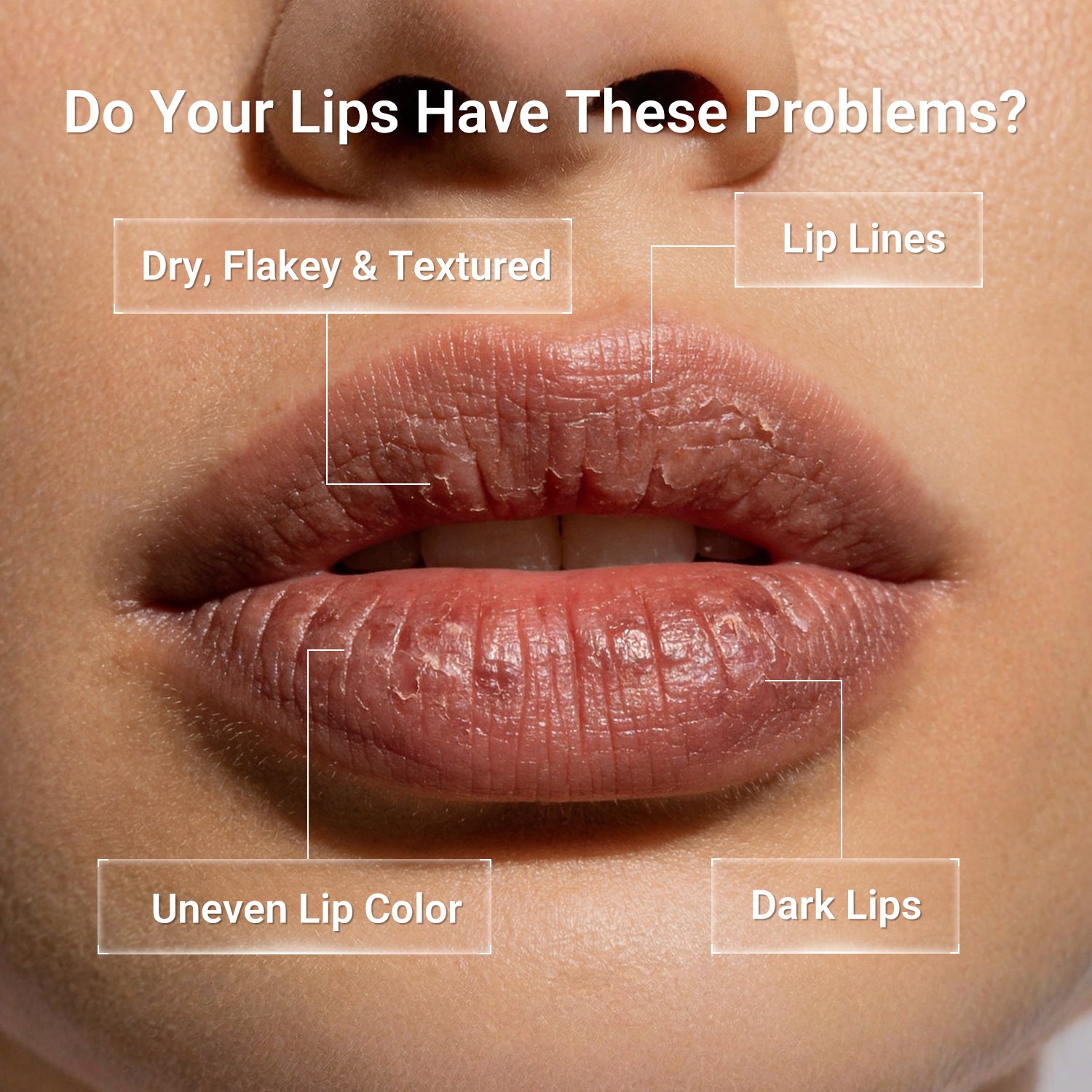 Peptides Nourishing Lip Serum