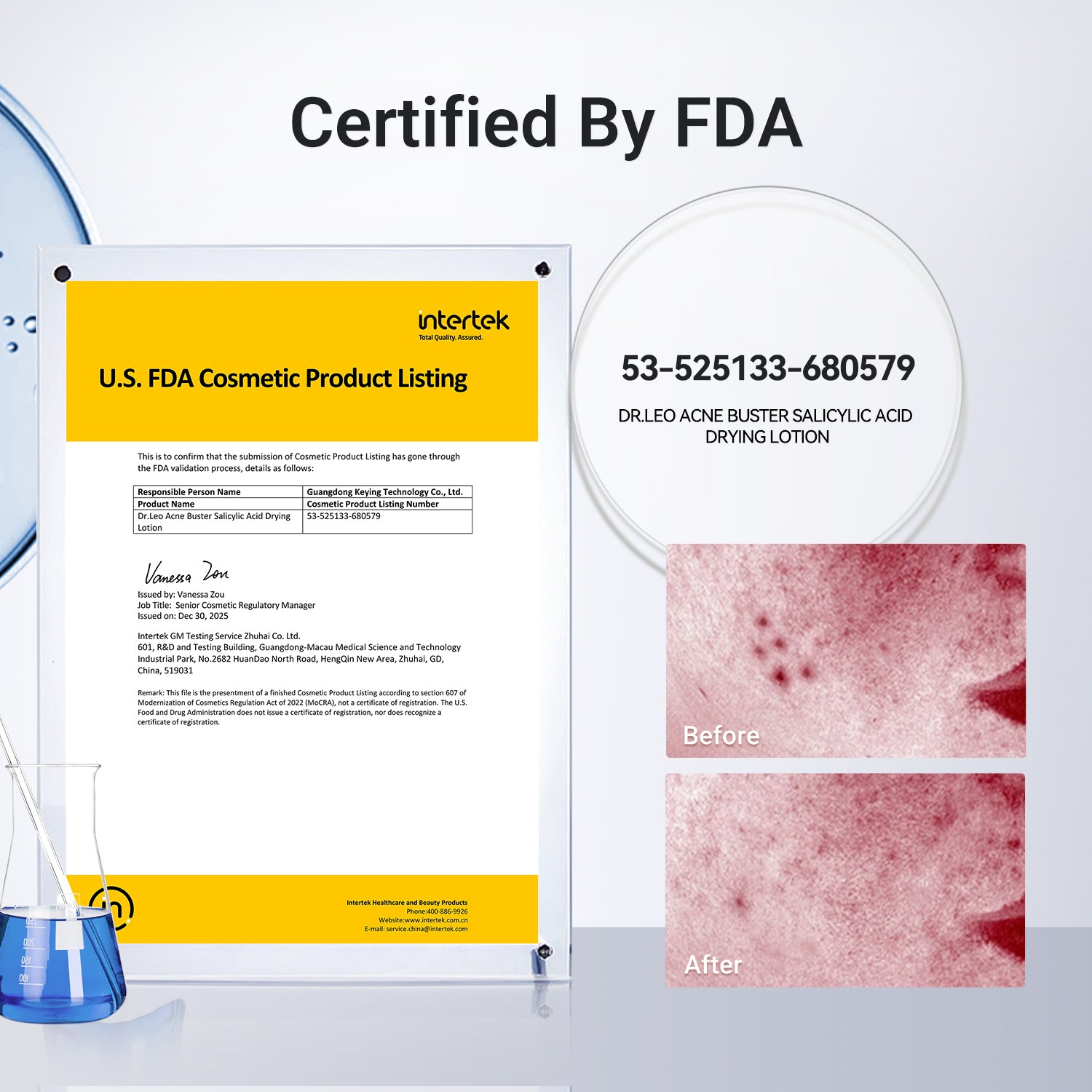 Acne Drying Lotion Plus (1.8% Encapsulated Salicylic Acid) — 20 mL