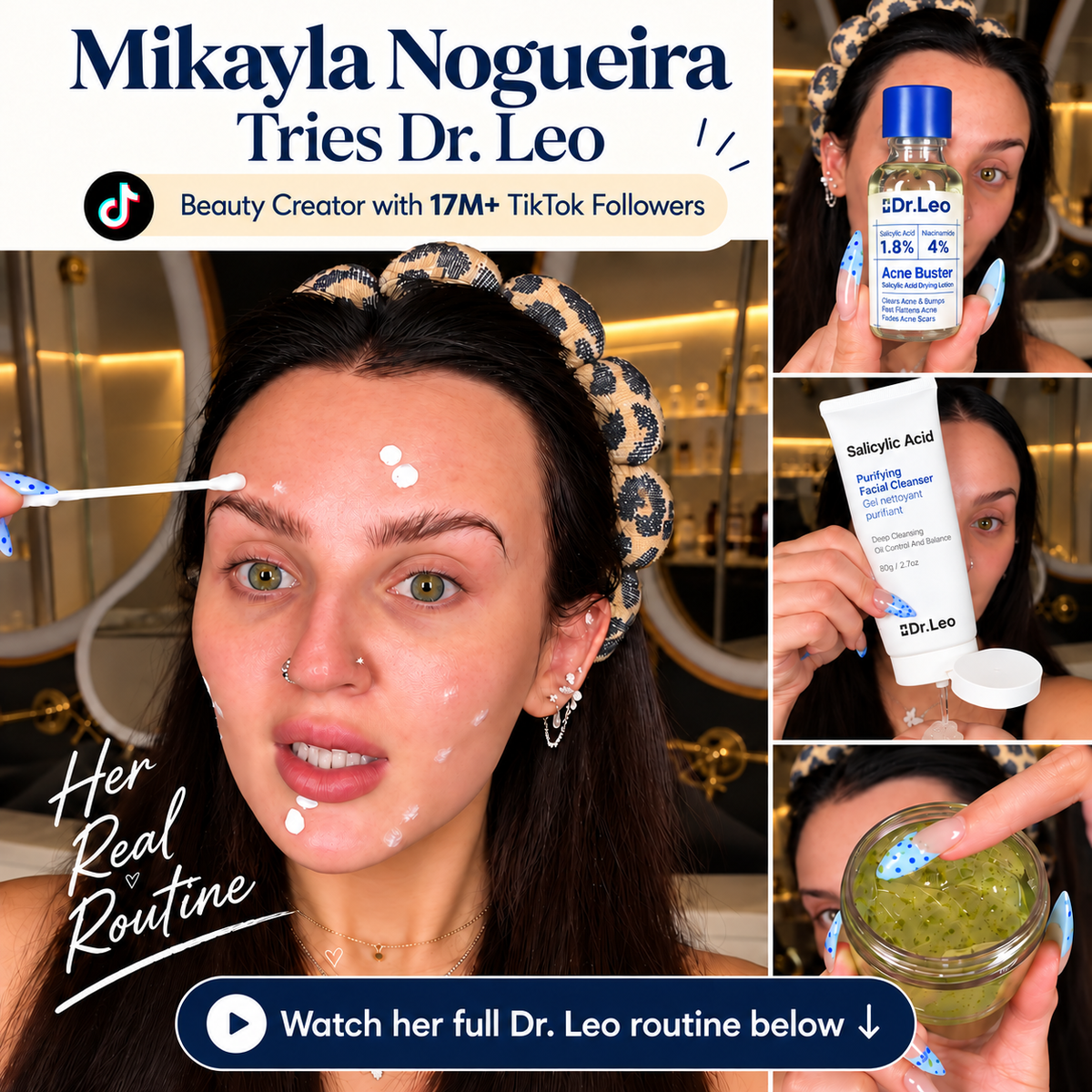 Acne Buster Kit