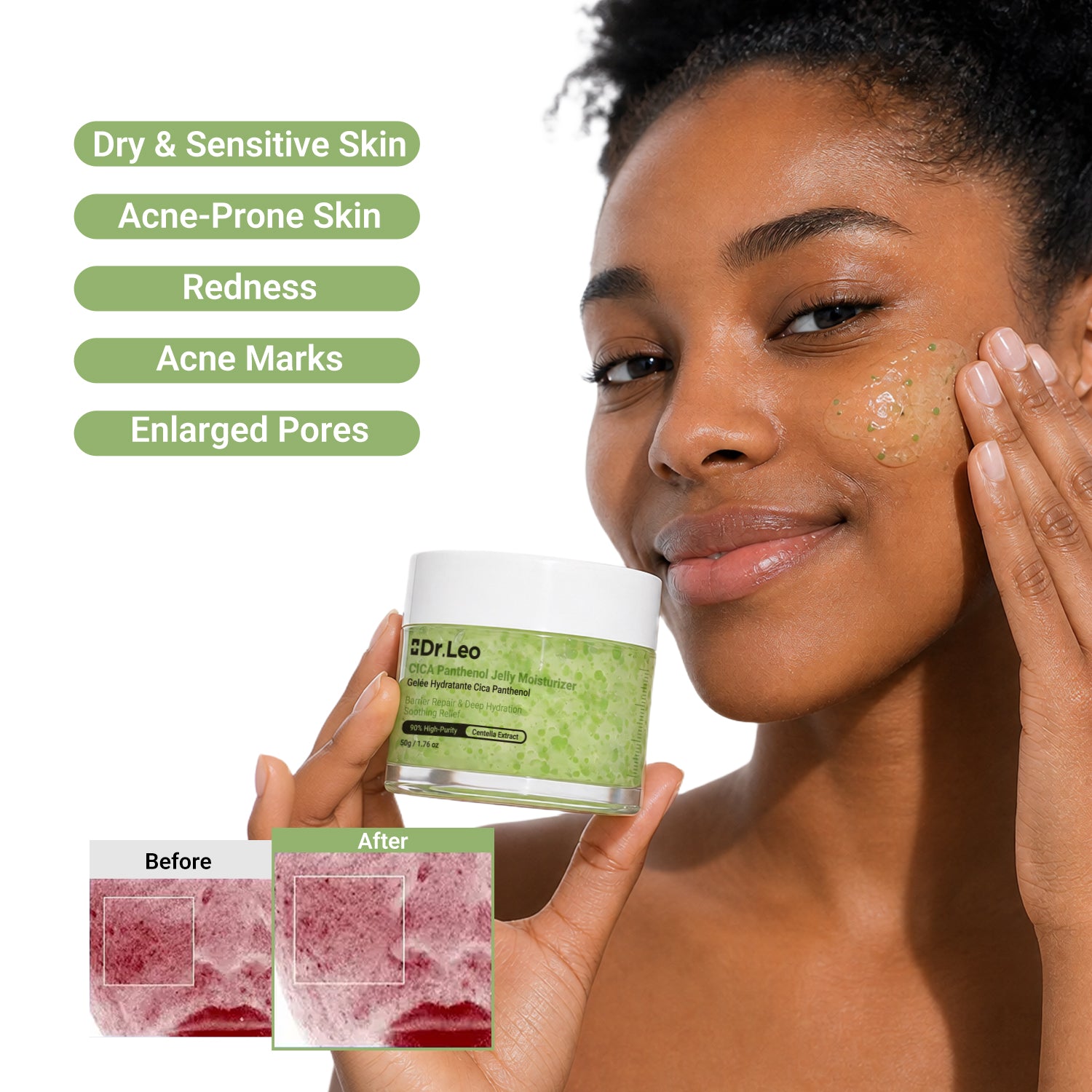 CICA Panthenol Hydro-Gel Soothing Moisturizer