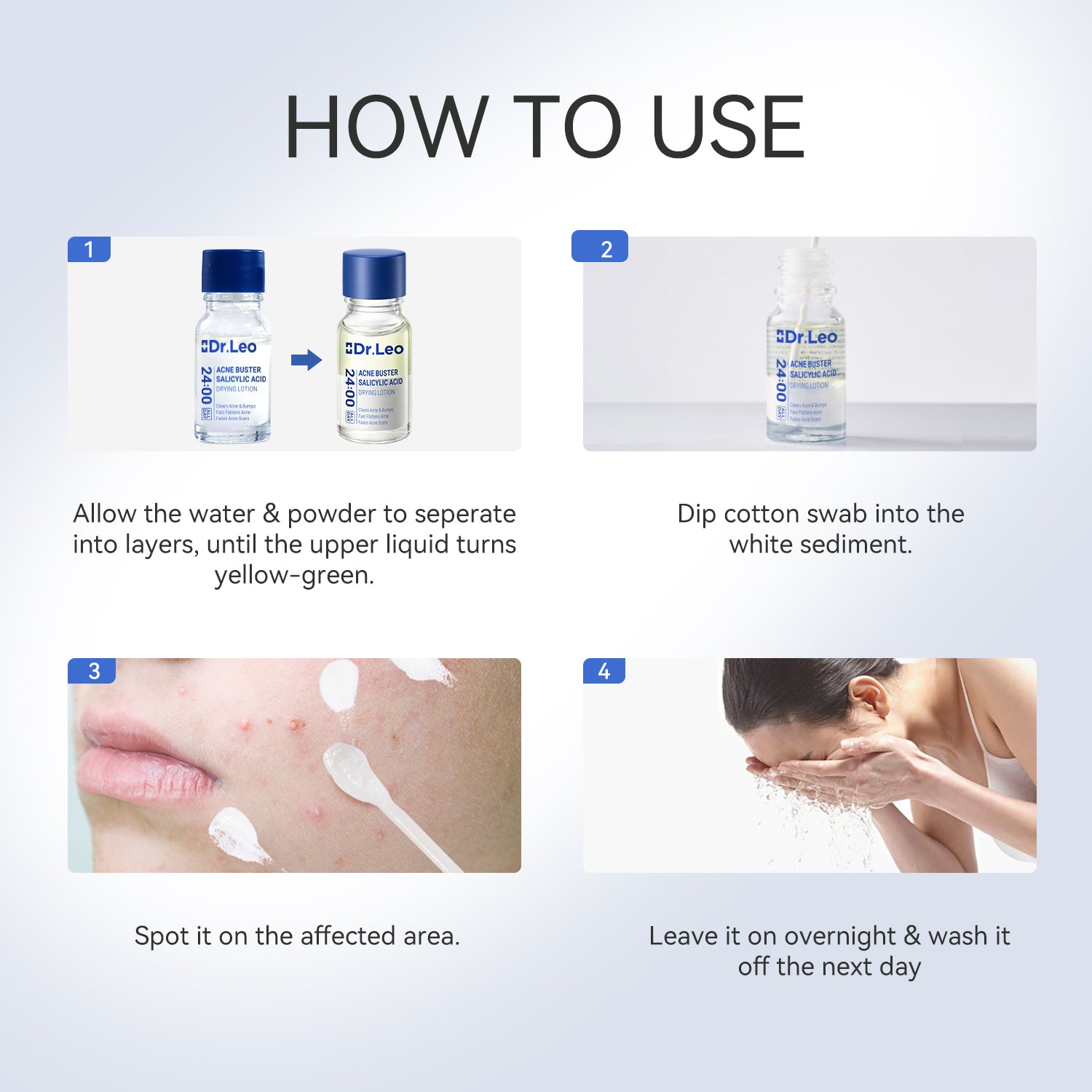 Loción secante para el tratamiento del acné con ácido salicílico – 3 piezas